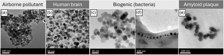 On the origin of metal species in the human brain: a perspective on key physicochemical properties.