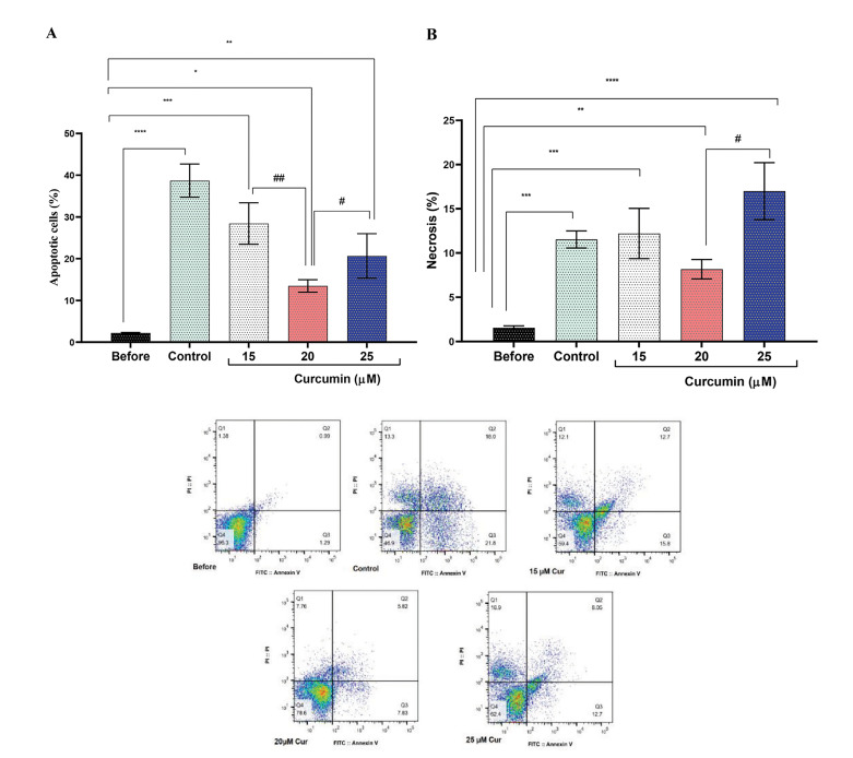 Curcumin Improved The Sperm Motility of Oligo-Asthenoteratozoospermia Patients during Cryopreservation by Regulating Mitochondrial Apoptotic Pathway Genes and Improving The Antioxidant Capacity of Cells.