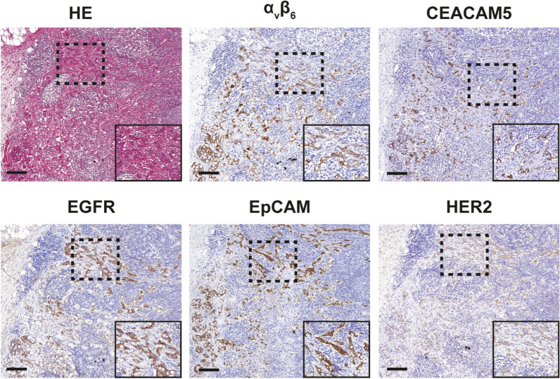 Selecting Targets for Molecular Imaging of Gastric Cancer: An Immunohistochemical Evaluation.