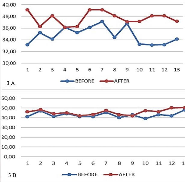 Dentoalveolar changes and transverse discrepancies through the treatment of class II division 1 malocclusion in children using a twin block device.