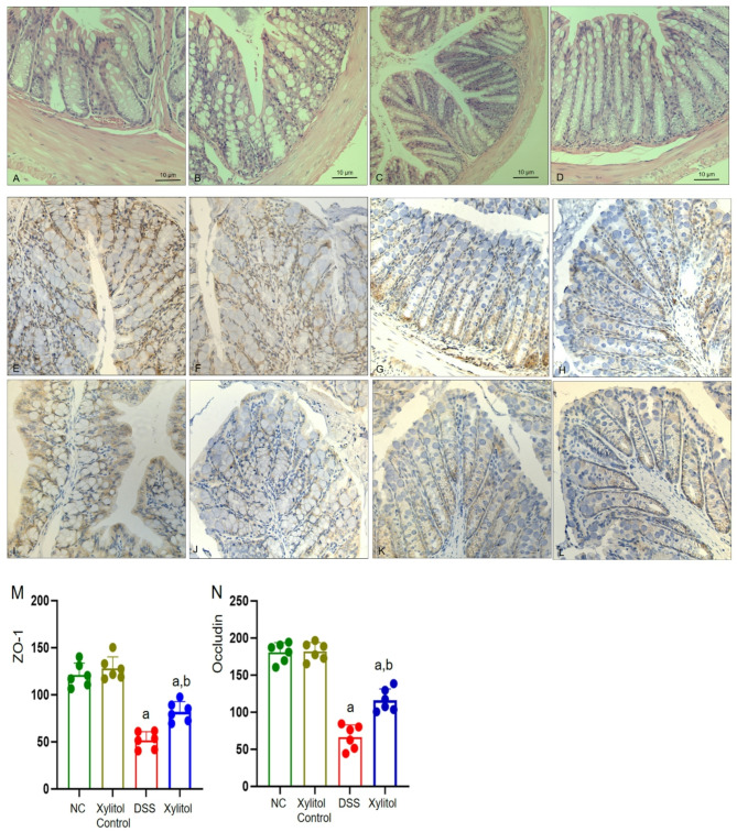 Using gut microbiota and non-targeted metabolomics techniques to study the effect of xylitol on alleviating DSS-induced inflammatory bowel disease in mice.
