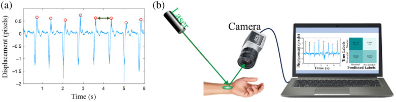 Remote sensing of alcohol consumption using machine learning speckle pattern analysis.