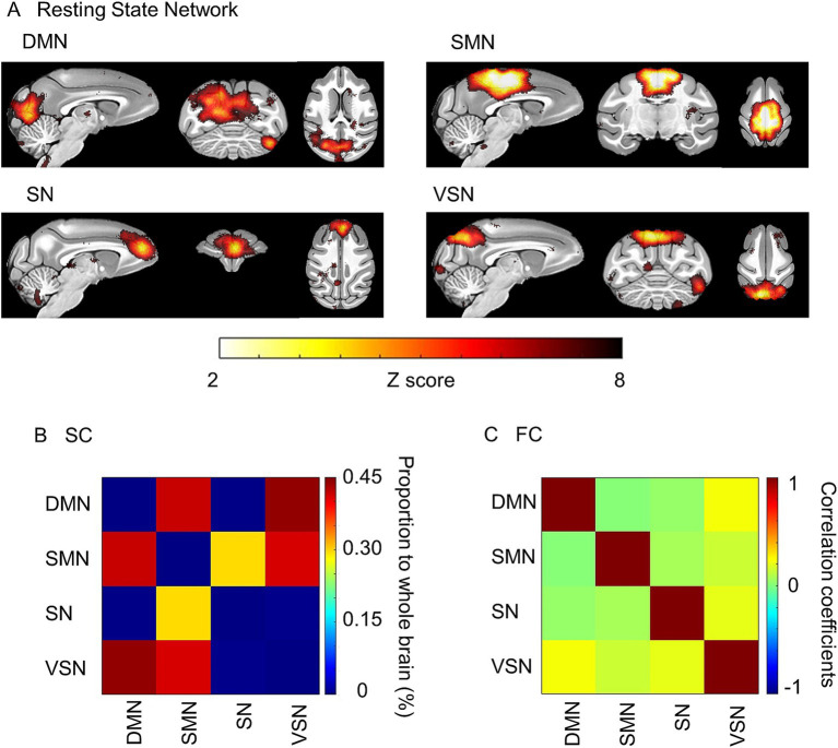 Age-related alterations in functional and structural networks in the brain in macaque monkeys.