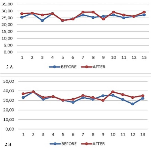 Dentoalveolar changes and transverse discrepancies through the treatment of class II division 1 malocclusion in children using a twin block device.