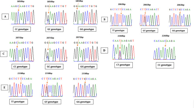 Fatty acids profile in Awassi sheep milk affected by some genes' single and combined effects.