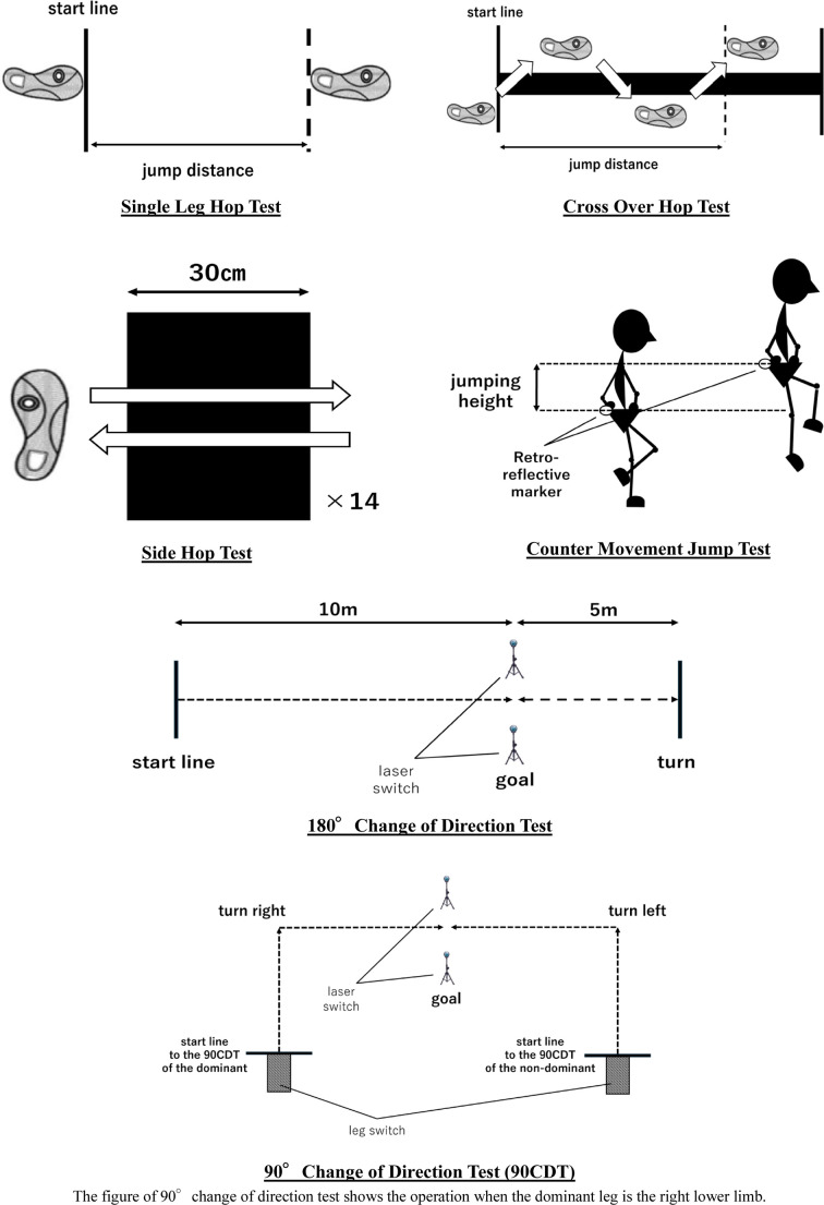 Lower-limb asymmetry in healthy male athletes.