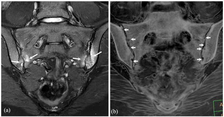 What's new in pediatric musculoskeletal imaging.
