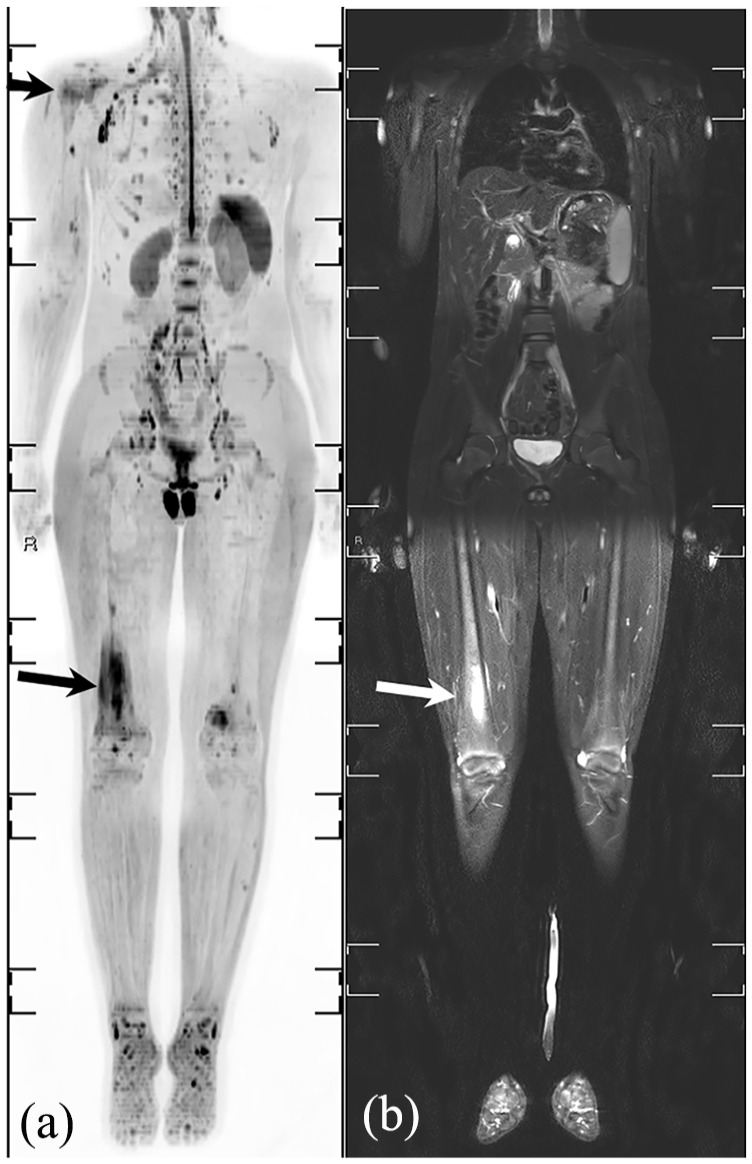 What's new in pediatric musculoskeletal imaging.