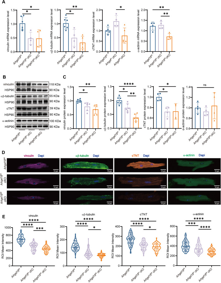 Establishment and functional studies of a model of cardiomyopathy with cardiomyocyte-specific conditional knockout of Arhgef18.
