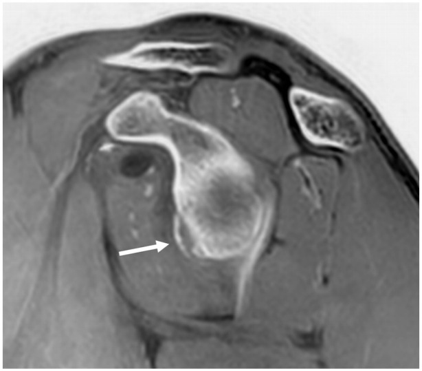 What's new in pediatric musculoskeletal imaging.