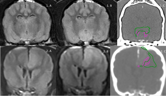 Peritumoral Edema in Canine Extra-Axial Brain Tumours: Effect of Steroids.