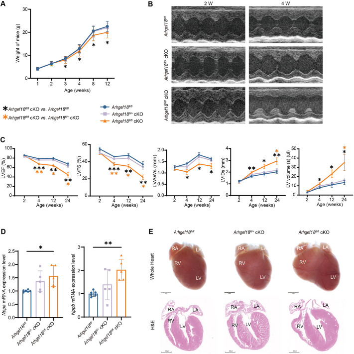 Establishment and functional studies of a model of cardiomyopathy with cardiomyocyte-specific conditional knockout of Arhgef18.