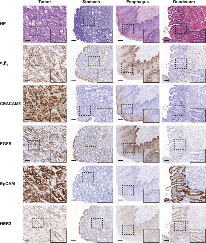 Selecting Targets for Molecular Imaging of Gastric Cancer: An Immunohistochemical Evaluation.