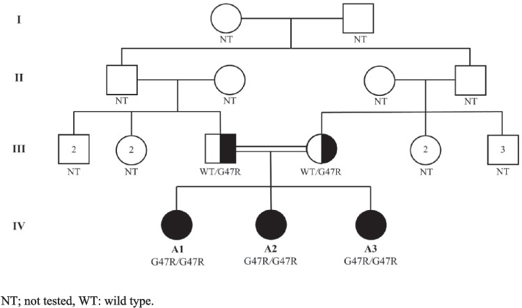 Deficiency of Adenosine Deaminase 2 Masquerading as Behçet's Disease: Phenotypic Mimicry with HLA-B*51 Positivity.