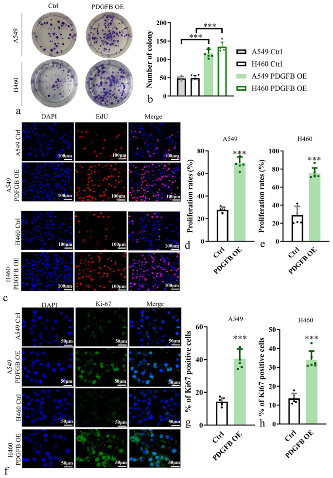 Platelet-derived growth factor subunit B overexpression promotes lung cancer tumor growth and metastasis: The role of glucose metabolism.