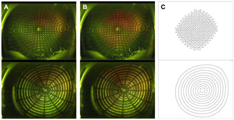 Quantifying retinal size and shape distortion in different ultra-widefield imaging systems.