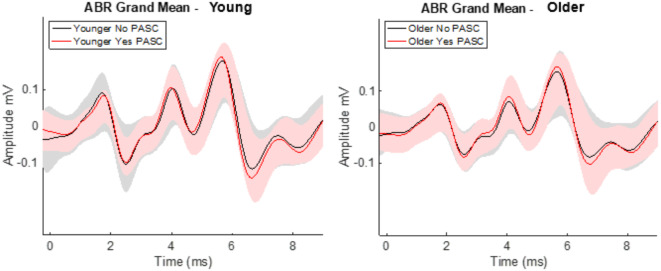 Altered auditory brainstem responses are post-acute sequela of SARS-CoV-2 (PASC).