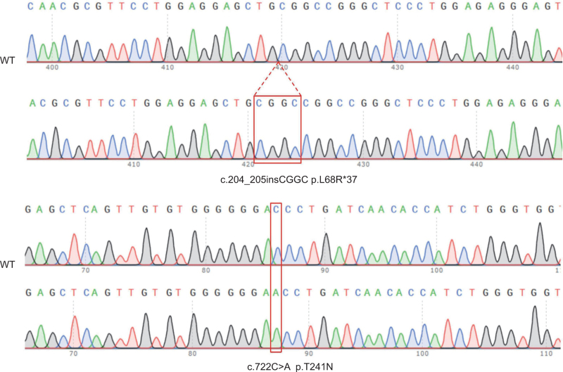 Compound heterozygous mutations (p.L68R∗37 and p.T241N) lead to abnormal protein levels and structures in hereditary FVII deficiency.