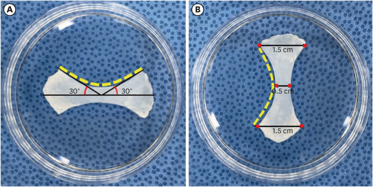 Comparison of five preservation methods for fascia allograft.