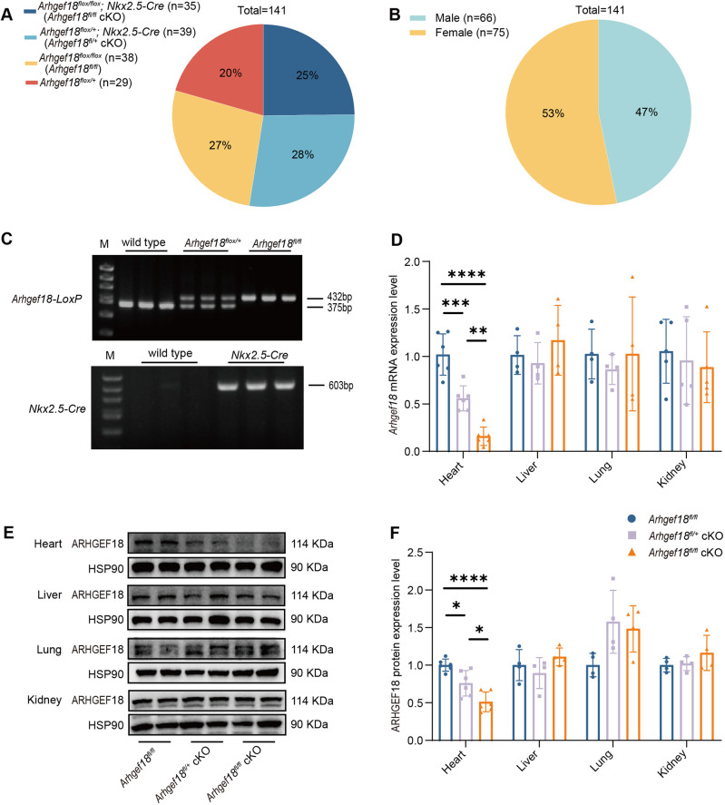 Establishment and functional studies of a model of cardiomyopathy with cardiomyocyte-specific conditional knockout of Arhgef18.