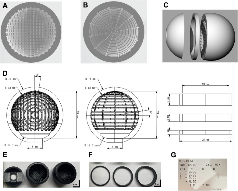 Quantifying retinal size and shape distortion in different ultra-widefield imaging systems.