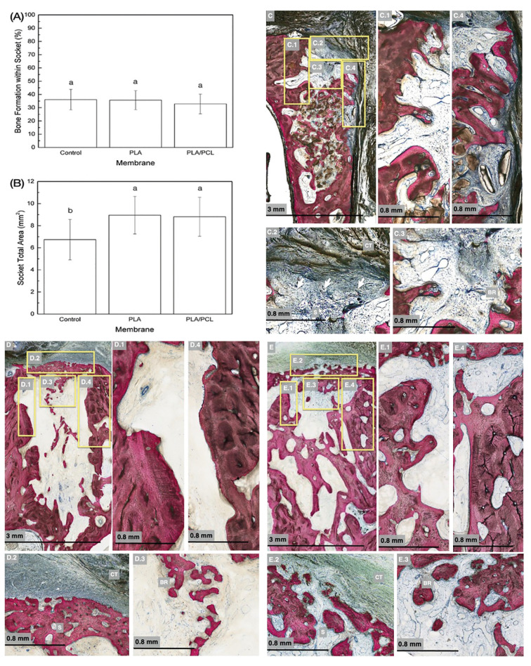 Socket preservation utilizing polymeric bioresorbable membranes: a preclinical model.