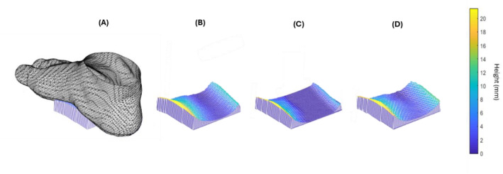 Three-dimensional differences in plantar surface shape captured by methods used for custom accommodative insole design.