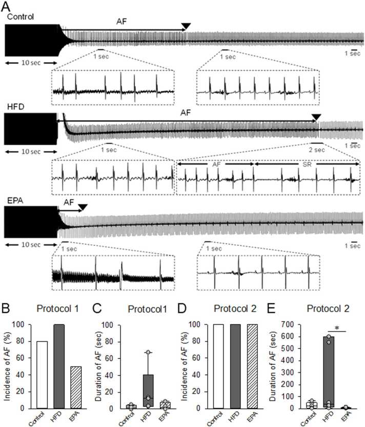 Eicosapentaenoic acid prevents atrial electrocardiographic impairments and atrial fibrillation in high fat diet mice.