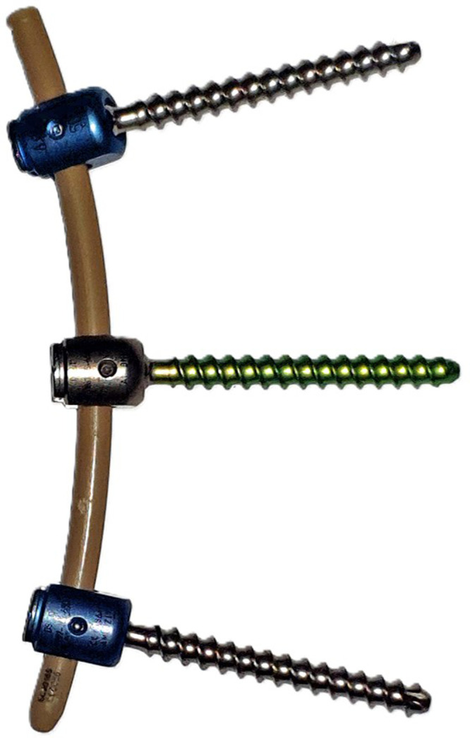 A PEEK Rod-Based Dynamic Instrumentation Construct for the Degenerative Lumbar Spine Disease, First Appraisal Based on Five-year Clinical and Radiological Findings.
