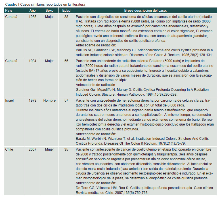 [Colitis cystica profunda induced by radiation 27 years later. Case report].