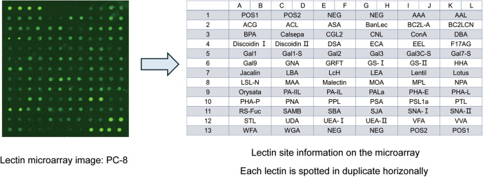 Glycomic profiling of parathyroid neoplasms via lectin microarray analysis.