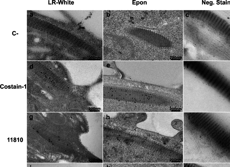 Immunolocalization and 3D modeling of three unique proteins belonging to the costa of Tritrichomonas foetus.