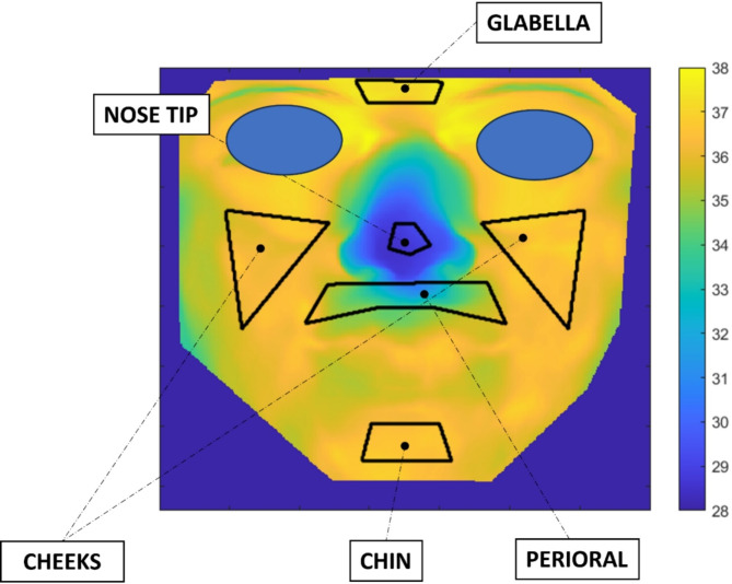 Autonomic correlates of osteopathic manipulative treatment on facial functional mapping: an innovative approach based on thermal imaging.
