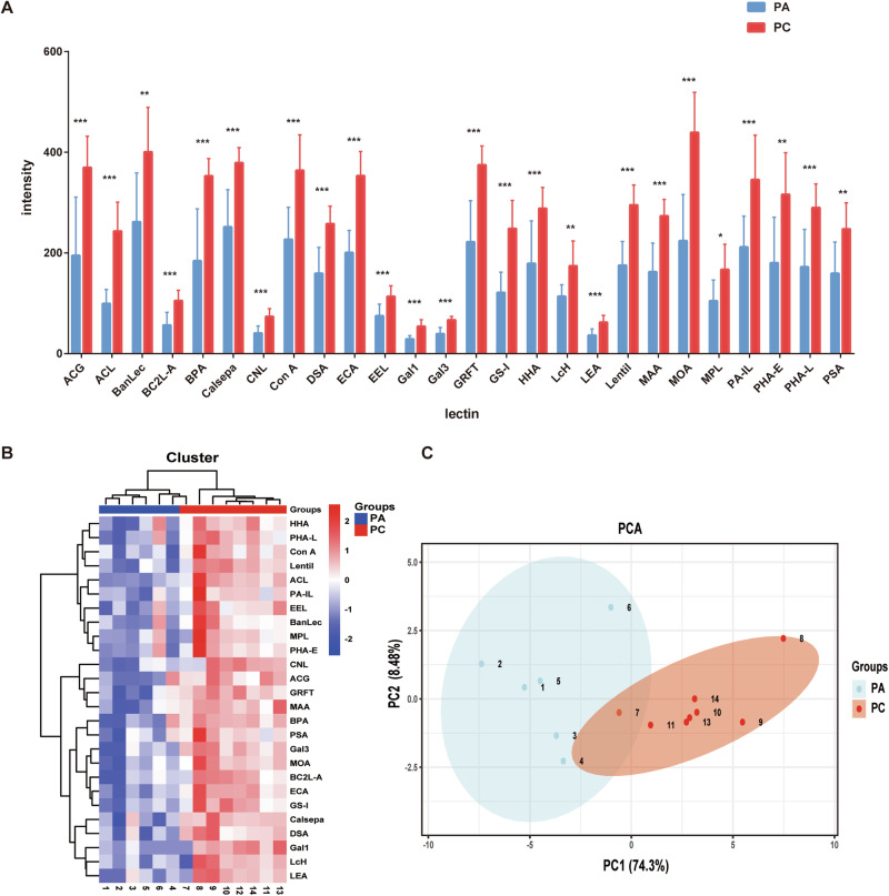 Glycomic profiling of parathyroid neoplasms via lectin microarray analysis.