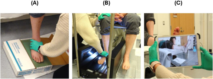 Three-dimensional differences in plantar surface shape captured by methods used for custom accommodative insole design.