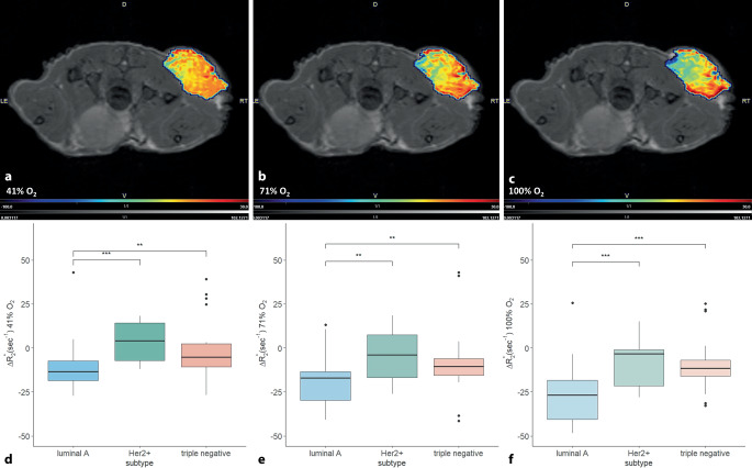 [Multiparametric magnetic resonance imaging of the breast : What can we expect from the future?]