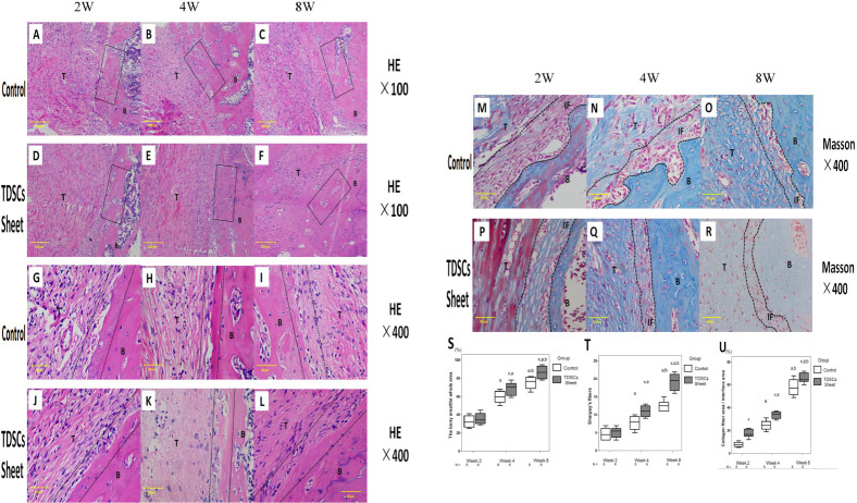Tendon-Derived Stem Cell Sheet Promotes Early-Stage Tendon-Bone Healing.