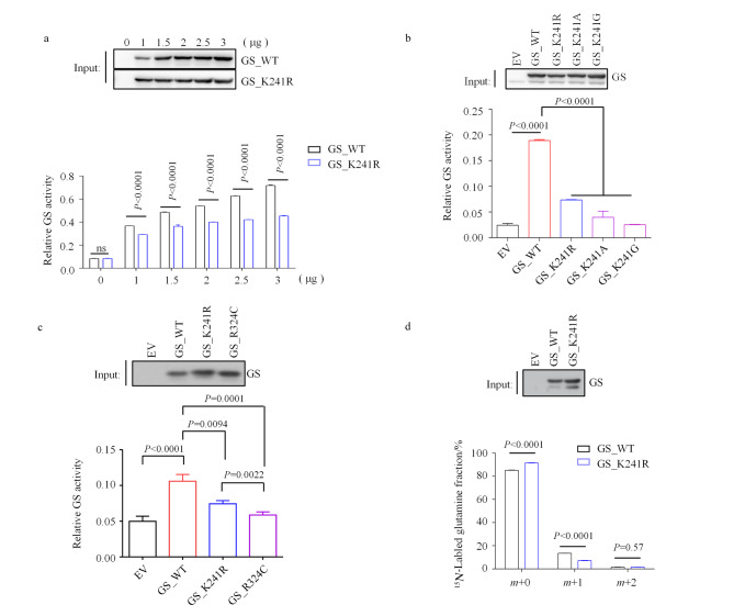 [Integrative transcriptomics-metabolomics approach to identify metabolic pathways regulated by glutamine synthetase activity].