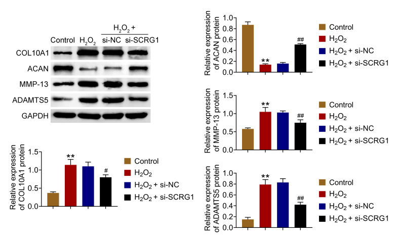 Loss of SCRG1 in chondrocytes inhibits osteoarthritis by promoting autophagy activity in the temporomandibular joint through inhibition of neurokine receptors.
