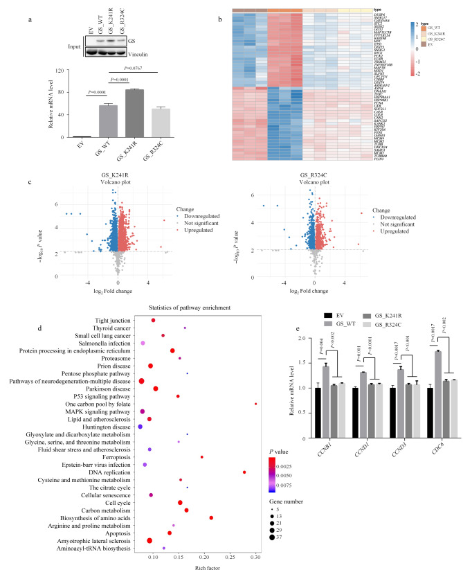 [Integrative transcriptomics-metabolomics approach to identify metabolic pathways regulated by glutamine synthetase activity].
