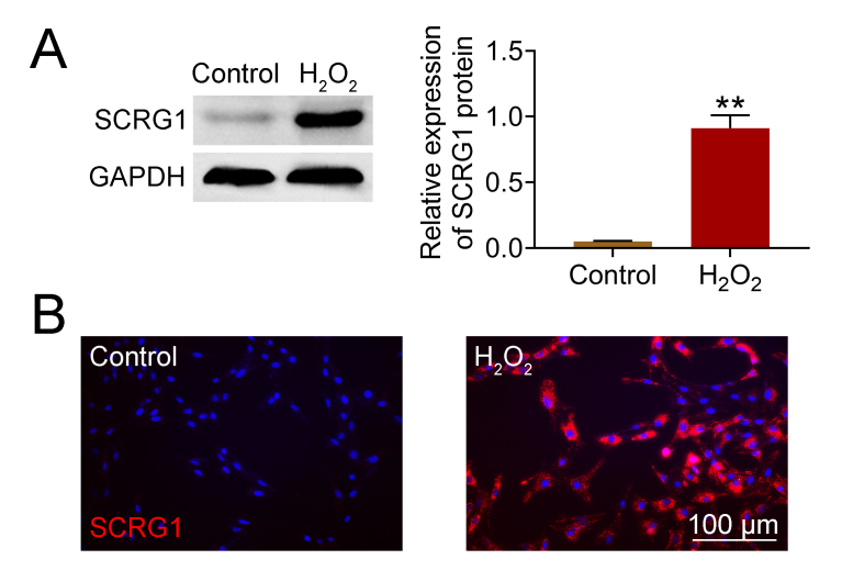 Loss of SCRG1 in chondrocytes inhibits osteoarthritis by promoting autophagy activity in the temporomandibular joint through inhibition of neurokine receptors.
