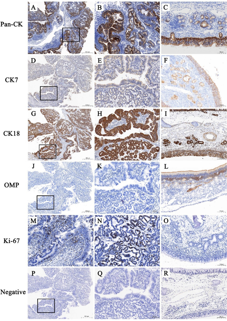 The pathological characteristics of enzootic nasal adenocarcinoma in goats.
