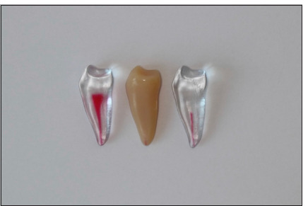Effectiveness of a 3D Printed Training Kit for the Preparation of Access Cavities in Calcified Teeth: A Pilot Study.