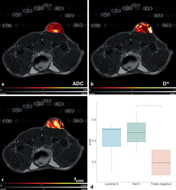 [Multiparametric magnetic resonance imaging of the breast : What can we expect from the future?]