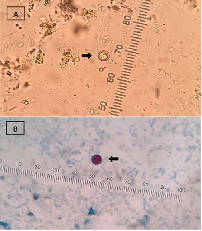 Molecular confirmation of Cryptosporidium and Cyclospora species in children with acute diarrhoea in Quindio region, Colombia.
