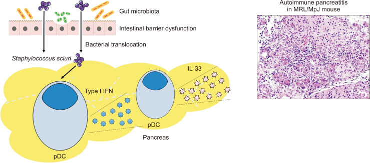 Gut Microbiota Involved in the Immunopathogenesis of Autoimmune Pancreatitis.