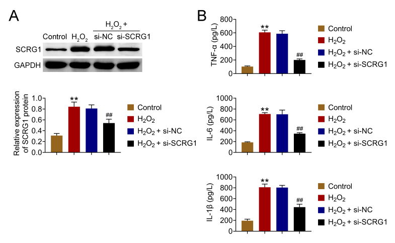 Loss of SCRG1 in chondrocytes inhibits osteoarthritis by promoting autophagy activity in the temporomandibular joint through inhibition of neurokine receptors.