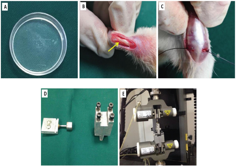 Tendon-Derived Stem Cell Sheet Promotes Early-Stage Tendon-Bone Healing.