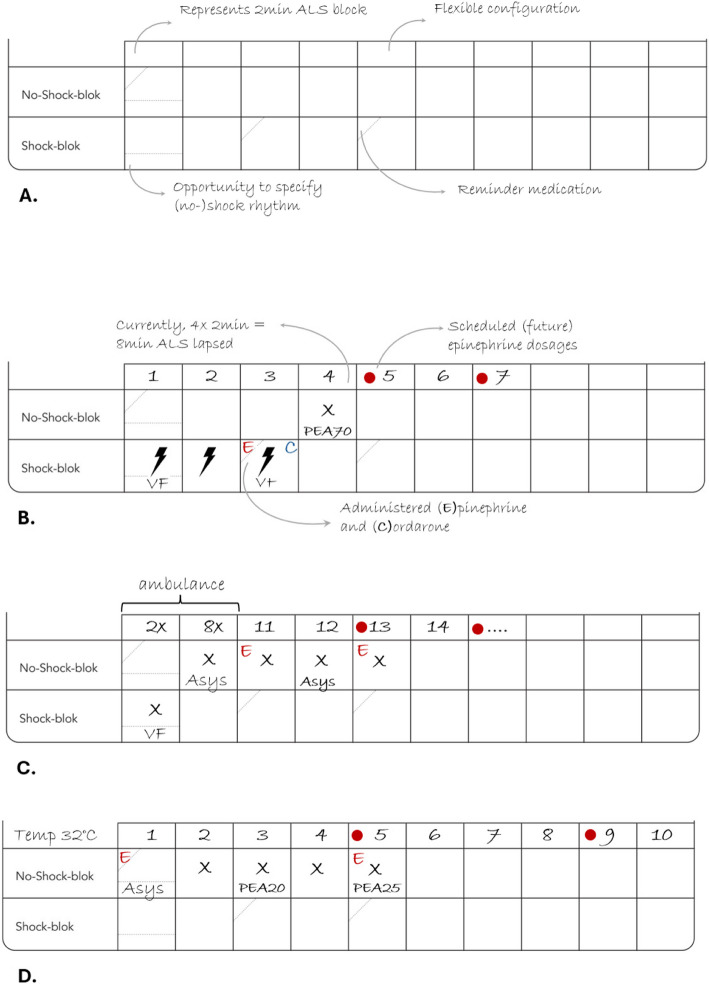 Getting ON-TRAC, a team-centred design study of a reflexivity aid to support resuscitation teams' information sharing.