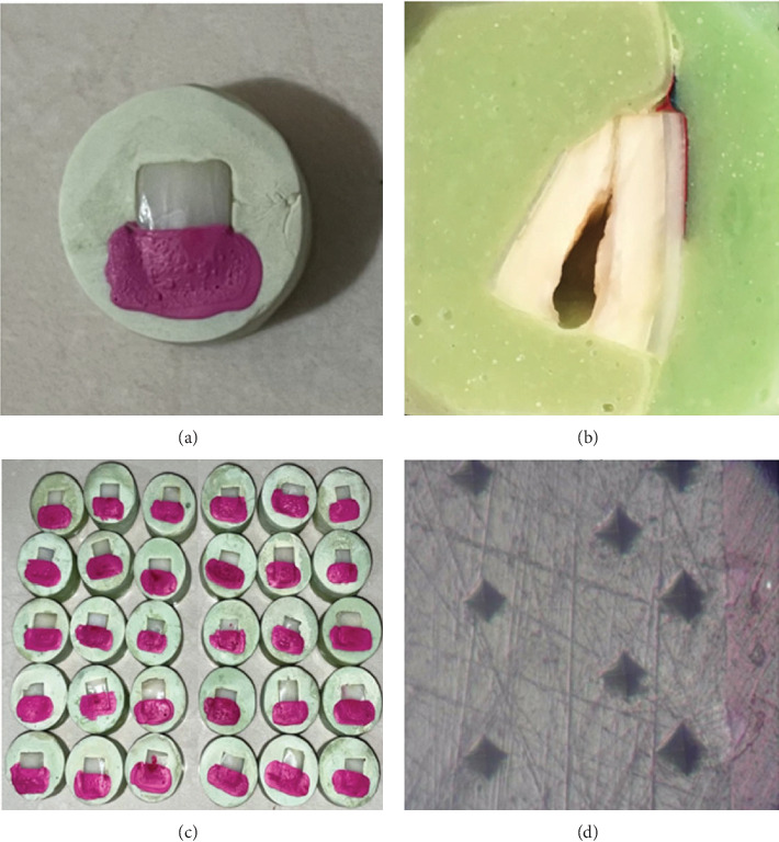 Efficacy of an Experimental CPP-ACP and Fluoride Toothpaste in Prevention of Enamel Demineralization: An In Vitro Study on Bovine Enamel.